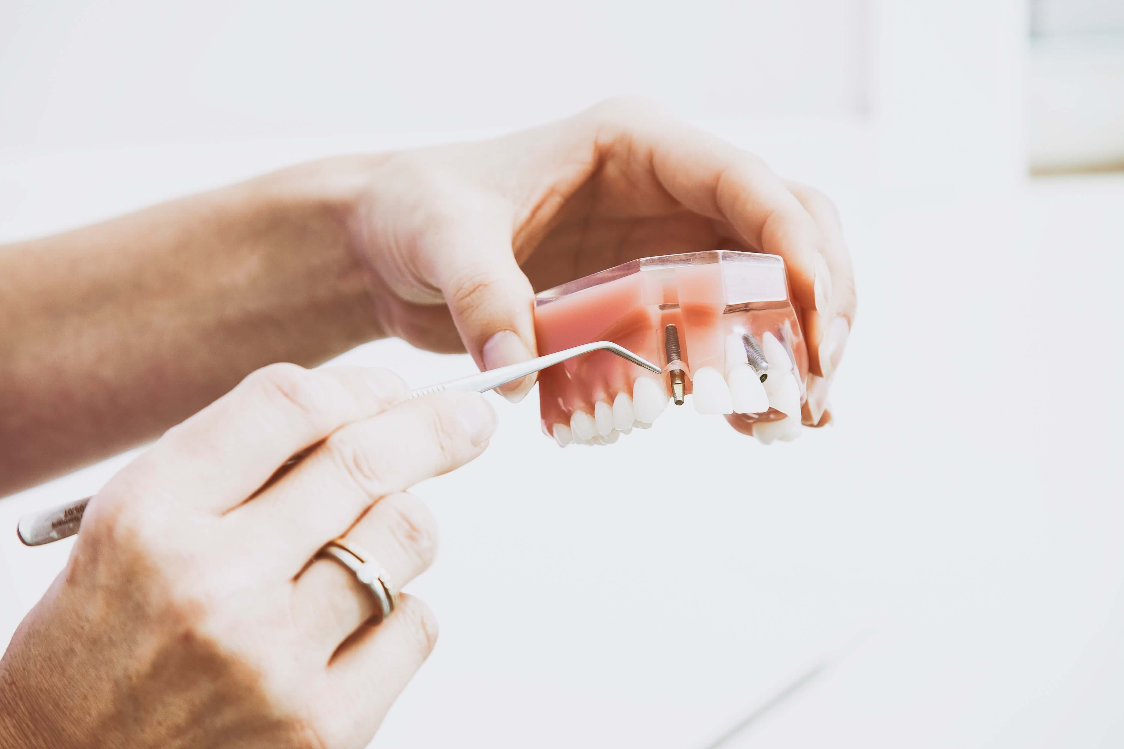 Dental Implant Renfrew